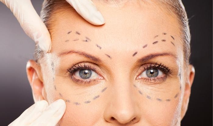 Qué son las patas de gallo y cómo eliminarlas