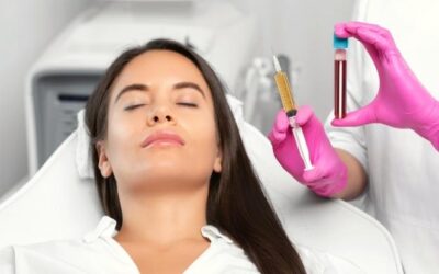 PRP Facial el Procedimiento Estético con Plasma