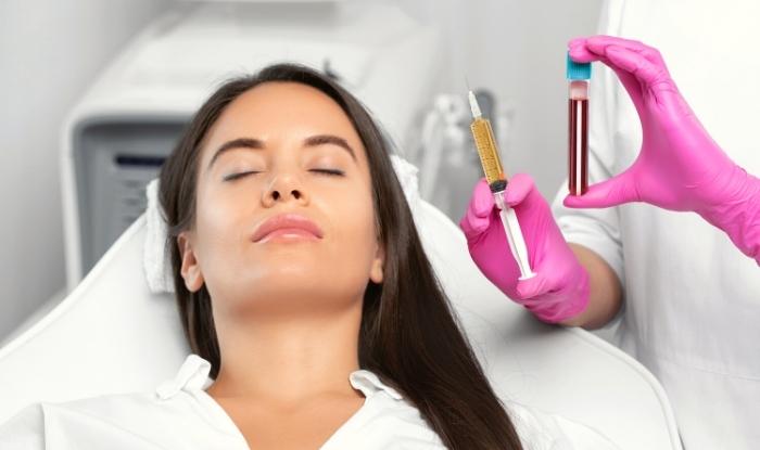 PRP Facial el Procedimiento Estético con Plasma