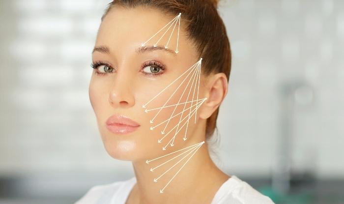 Beneficios de Hilos Tensores de PDO