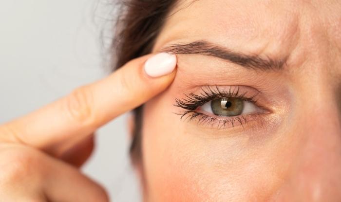 Todo lo que debes saber sobre los párpados caídos